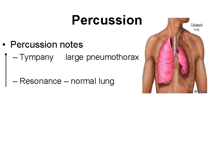 Percussion • Percussion notes – Tympany large pneumothorax – Resonance – normal lung 