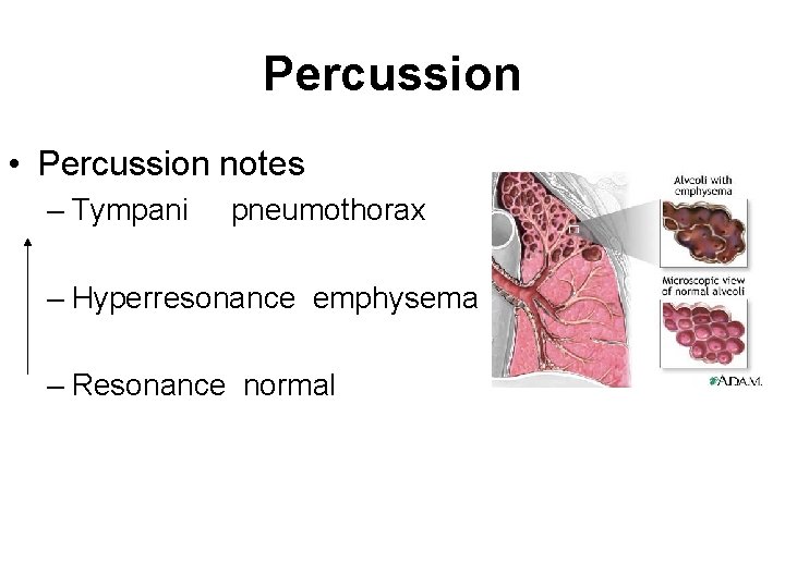 Percussion • Percussion notes – Tympani pneumothorax – Hyperresonance emphysema – Resonance normal 