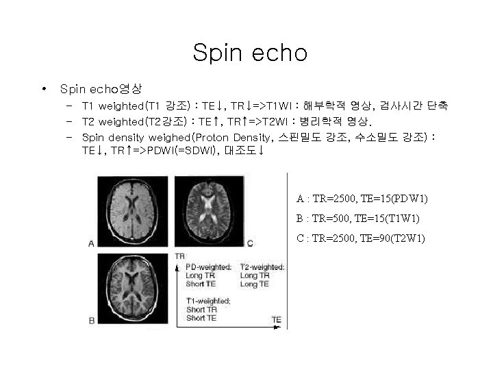 Spin echo • Spin echo영상 – T 1 weighted(T 1 강조) : TE↓, TR↓=>T Spin echo • Spin echo영상 – T 1 weighted(T 1 강조) : TE↓, TR↓=>T