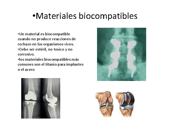 • Materiales biocompatibles • Un material es biocompatible cuando no produce reacciones de • Materiales biocompatibles • Un material es biocompatible cuando no produce reacciones de
