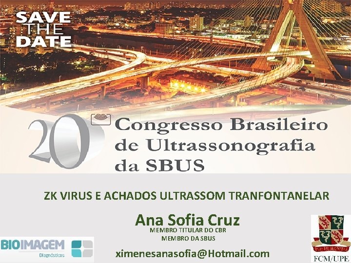 ZK VIRUS E ACHADOS ULTRASSOM TRANFONTANELAR Ana Sofia Cruz MEMBRO TITULAR DO CBR MEMBRO