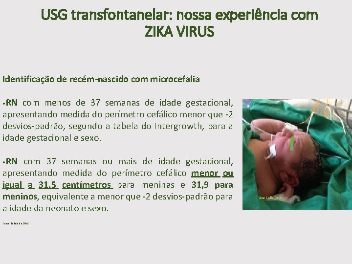 USG transfontanelar: nossa experiência com ZIKA VIRUS Identificação de recém-nascido com microcefalia • RN