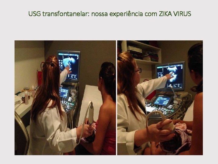 USG transfontanelar: nossa experiência com ZIKA VIRUS 