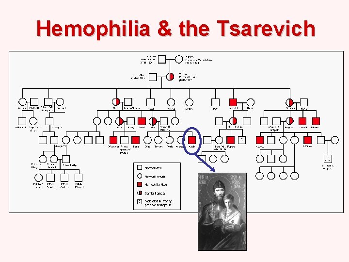 Hemophilia & the Tsarevich 