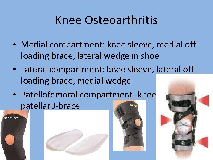 Knee Osteoarthritis • Medial compartment: knee sleeve, medial offloading brace, lateral wedge in shoe