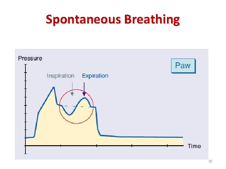 Spontaneous Breathing 20 