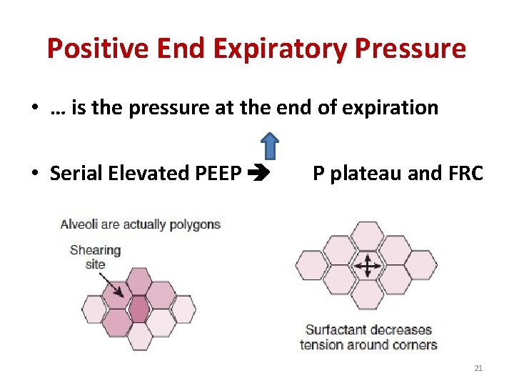 Positive End Expiratory Pressure • … is the pressure at the end of expiration