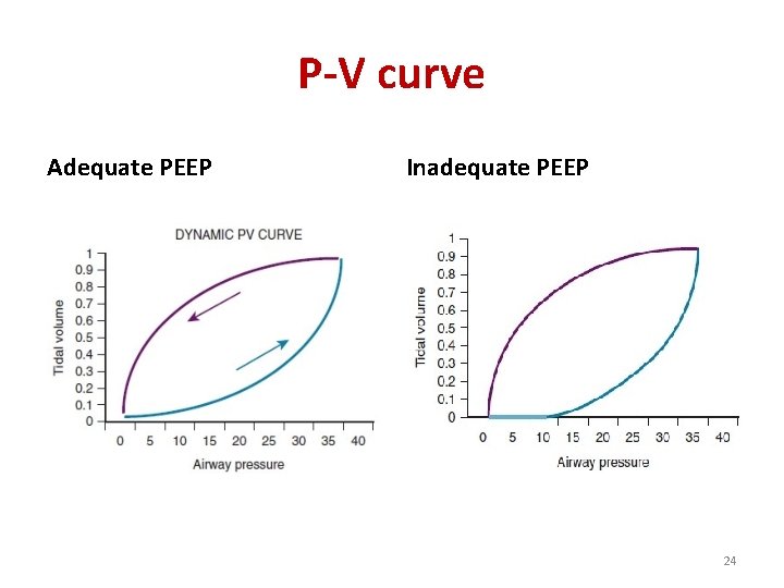 P-V curve Adequate PEEP Inadequate PEEP 24 