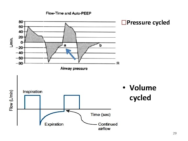 �Pressure cycled • Volume cycled 29 