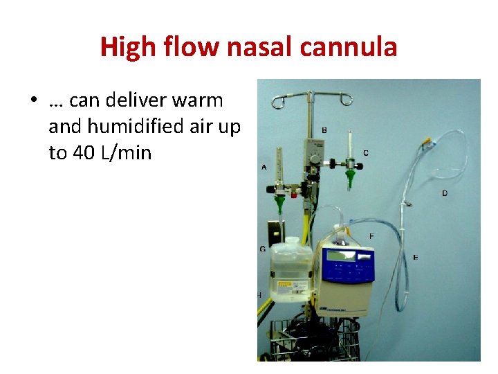 High flow nasal cannula • … can deliver warm and humidified air up to