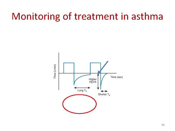 Monitoring of treatment in asthma 95 