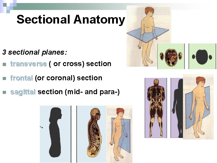 Sectional Anatomy 3 sectional planes: n transverse ( or cross) section n frontal (or