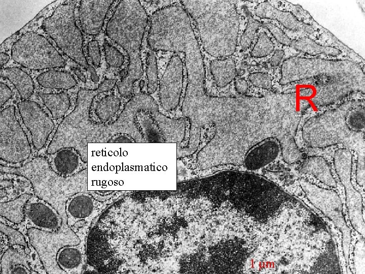 reticolo endoplasmatico rugoso in citoplasma di neurone (sostanza di Nissl) R reticolo endoplasmatico rugoso