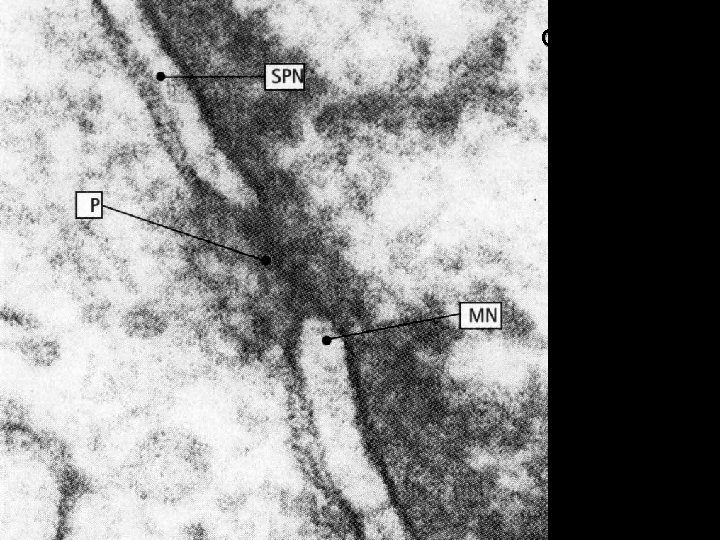 cromatina: il materiale intensamente colorabile (ed elettrondenso) presente nel nucleo. si osserva con diversi