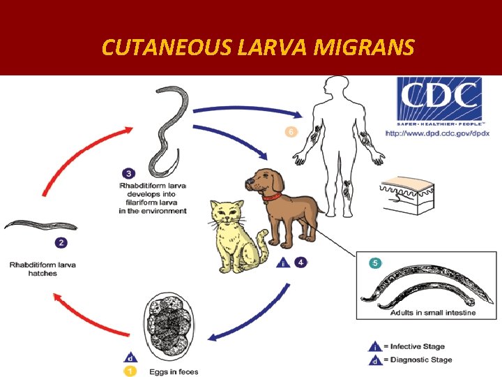 CUTANEOUS LARVA MIGRANS 