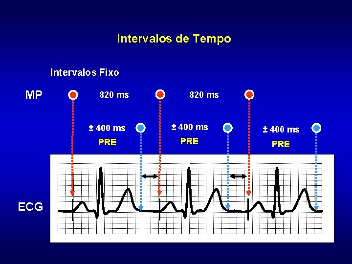 Intervalos de Tempo Intervalos Fixo MP ECG 820 ms ± 400 ms PRE PRE