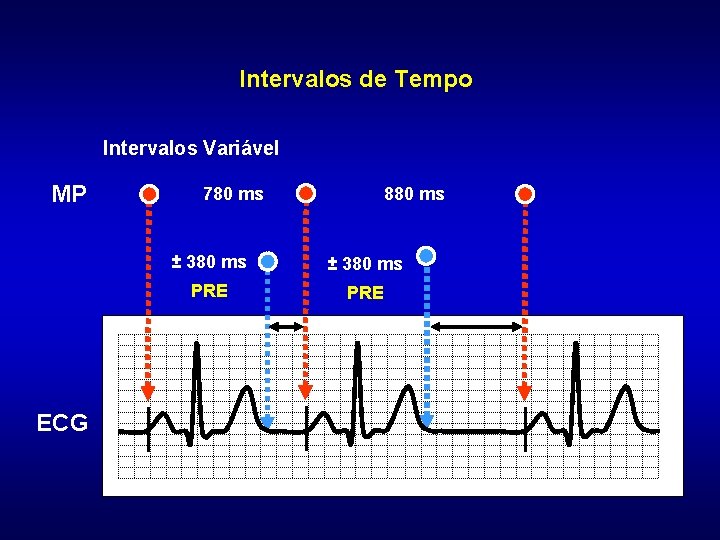 Intervalos de Tempo Intervalos Variável MP ECG 780 ms 880 ms ± 380 ms