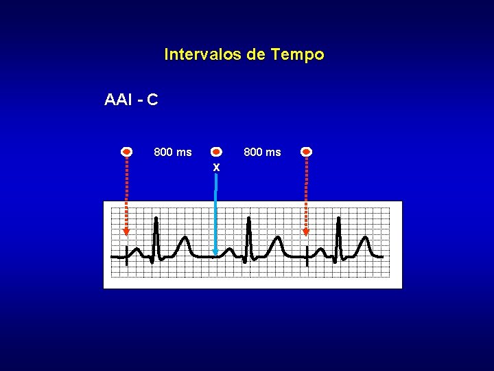 Intervalos de Tempo AAI - C 800 ms x 