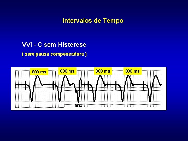 Intervalos de Tempo VVI - C sem Histerese ( sem pausa compensadora ) 800