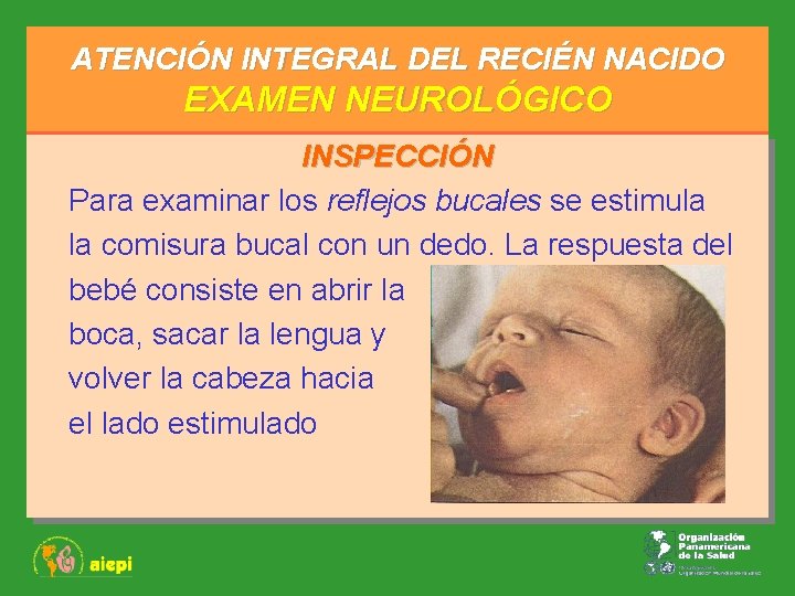 ATENCIÓN INTEGRAL DEL RECIÉN NACIDO EXAMEN NEUROLÓGICO INSPECCIÓN Para examinar los reflejos bucales se