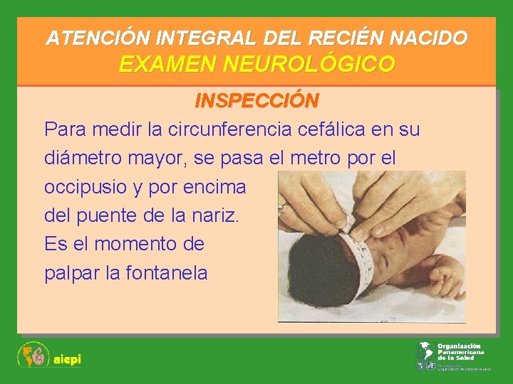 ATENCIÓN INTEGRAL DEL RECIÉN NACIDO EXAMEN NEUROLÓGICO INSPECCIÓN Para medir la circunferencia cefálica en