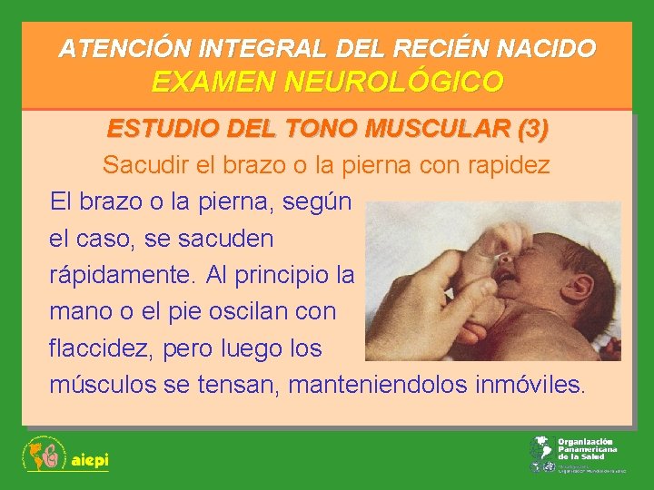 ATENCIÓN INTEGRAL DEL RECIÉN NACIDO EXAMEN NEUROLÓGICO ESTUDIO DEL TONO MUSCULAR (3) Sacudir el