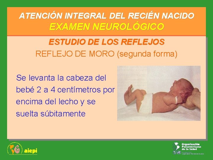 ATENCIÓN INTEGRAL DEL RECIÉN NACIDO EXAMEN NEUROLÓGICO ESTUDIO DE LOS REFLEJO DE MORO (segunda