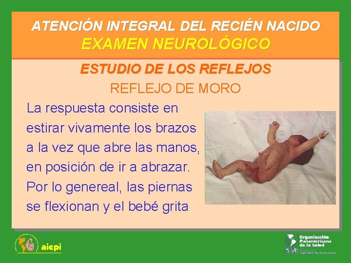 ATENCIÓN INTEGRAL DEL RECIÉN NACIDO EXAMEN NEUROLÓGICO ESTUDIO DE LOS REFLEJO DE MORO La