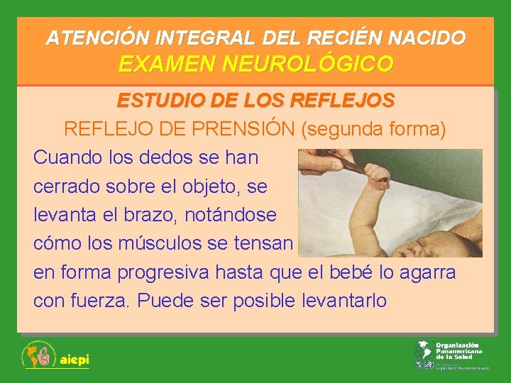 ATENCIÓN INTEGRAL DEL RECIÉN NACIDO EXAMEN NEUROLÓGICO ESTUDIO DE LOS REFLEJO DE PRENSIÓN (segunda