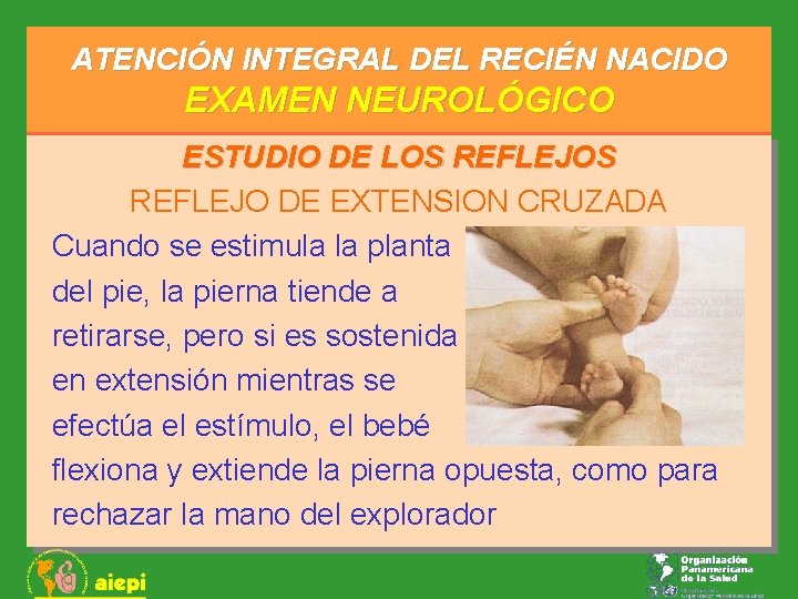 ATENCIÓN INTEGRAL DEL RECIÉN NACIDO EXAMEN NEUROLÓGICO ESTUDIO DE LOS REFLEJO DE EXTENSION CRUZADA