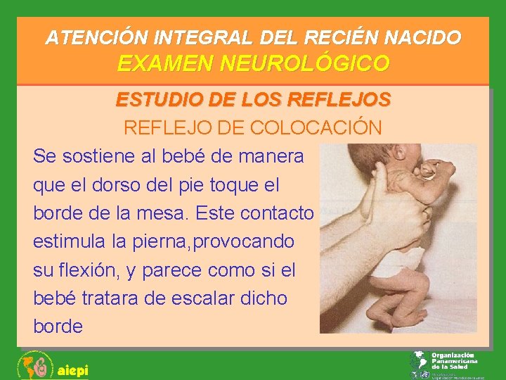 ATENCIÓN INTEGRAL DEL RECIÉN NACIDO EXAMEN NEUROLÓGICO ESTUDIO DE LOS REFLEJO DE COLOCACIÓN Se