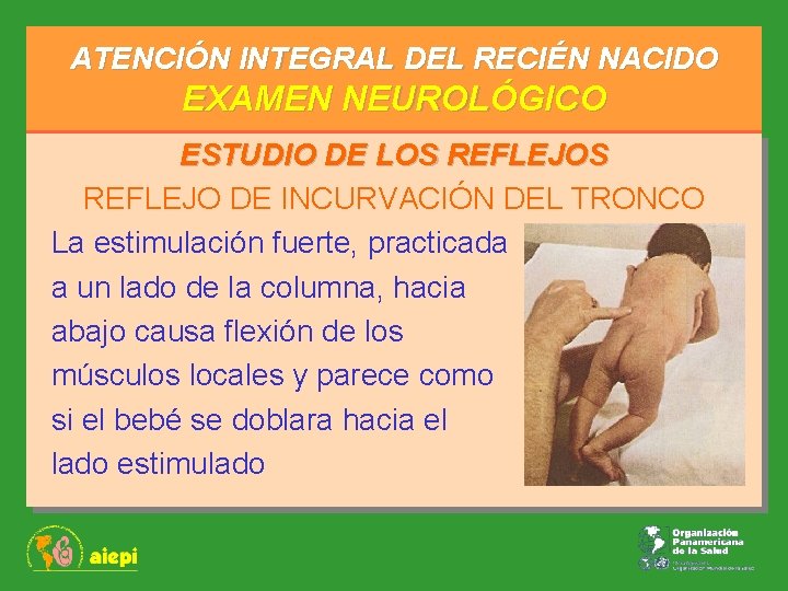 ATENCIÓN INTEGRAL DEL RECIÉN NACIDO EXAMEN NEUROLÓGICO ESTUDIO DE LOS REFLEJO DE INCURVACIÓN DEL