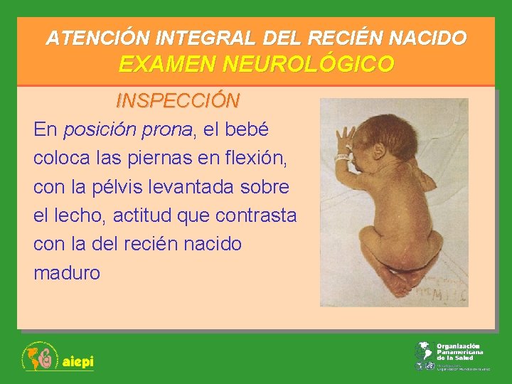 ATENCIÓN INTEGRAL DEL RECIÉN NACIDO EXAMEN NEUROLÓGICO INSPECCIÓN En posición prona, el bebé coloca