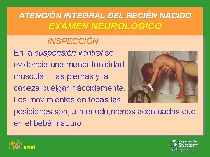 ATENCIÓN INTEGRAL DEL RECIÉN NACIDO EXAMEN NEUROLÓGICO INSPECCIÓN En la suspensión ventral se evidencia