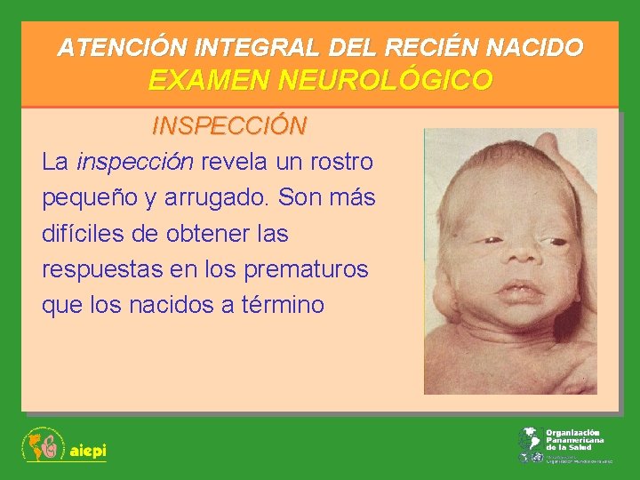 ATENCIÓN INTEGRAL DEL RECIÉN NACIDO EXAMEN NEUROLÓGICO INSPECCIÓN La inspección revela un rostro pequeño