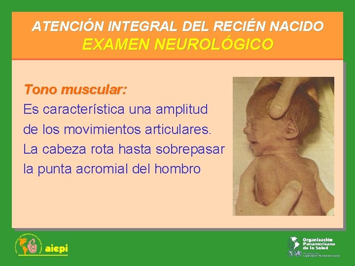 ATENCIÓN INTEGRAL DEL RECIÉN NACIDO EXAMEN NEUROLÓGICO Tono muscular: Es característica una amplitud de