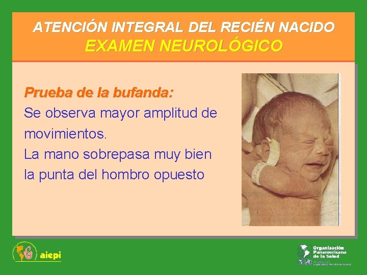 ATENCIÓN INTEGRAL DEL RECIÉN NACIDO EXAMEN NEUROLÓGICO Prueba de la bufanda: Se observa mayor