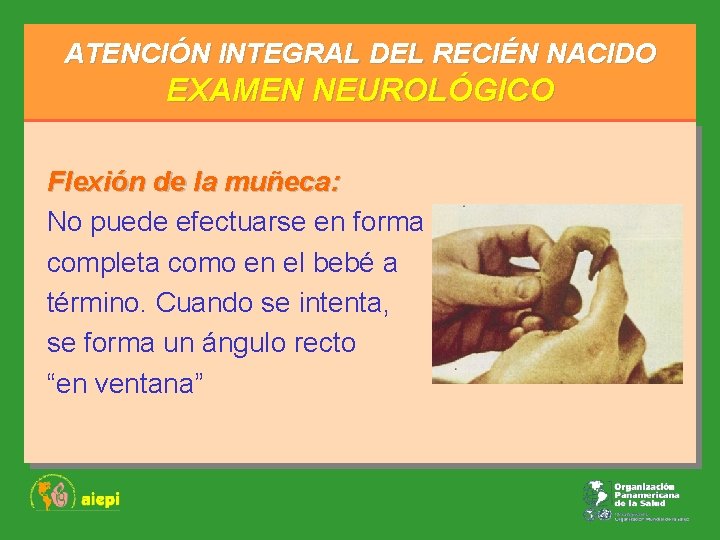ATENCIÓN INTEGRAL DEL RECIÉN NACIDO EXAMEN NEUROLÓGICO Flexión de la muñeca: No puede efectuarse