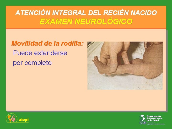 ATENCIÓN INTEGRAL DEL RECIÉN NACIDO EXAMEN NEUROLÓGICO Movilidad de la rodilla: Puede extenderse por