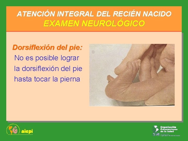 ATENCIÓN INTEGRAL DEL RECIÉN NACIDO EXAMEN NEUROLÓGICO Dorsiflexión del pie: No es posible lograr