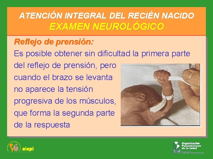 ATENCIÓN INTEGRAL DEL RECIÉN NACIDO EXAMEN NEUROLÓGICO Reflejo de prensión: Es posible obtener sin