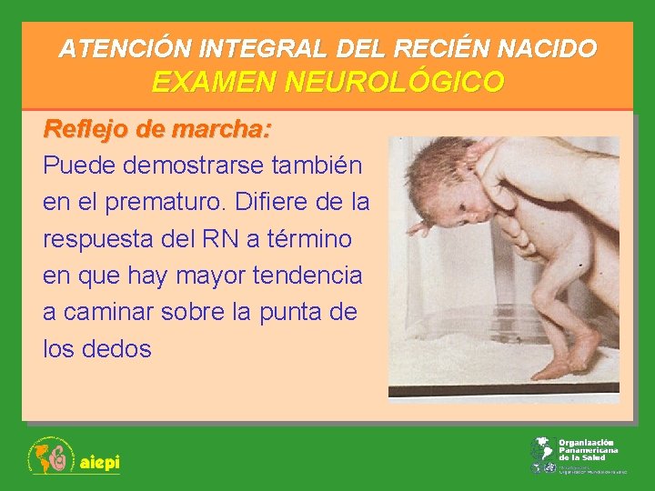 ATENCIÓN INTEGRAL DEL RECIÉN NACIDO EXAMEN NEUROLÓGICO Reflejo de marcha: Puede demostrarse también en