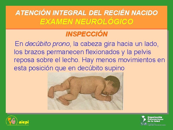 ATENCIÓN INTEGRAL DEL RECIÉN NACIDO EXAMEN NEUROLÓGICO INSPECCIÓN En decúbito prono, la cabeza gira