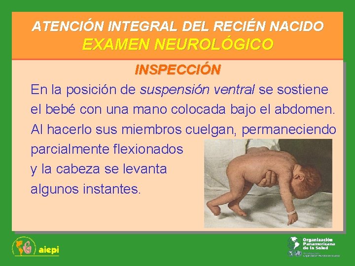 ATENCIÓN INTEGRAL DEL RECIÉN NACIDO EXAMEN NEUROLÓGICO INSPECCIÓN En la posición de suspensión ventral