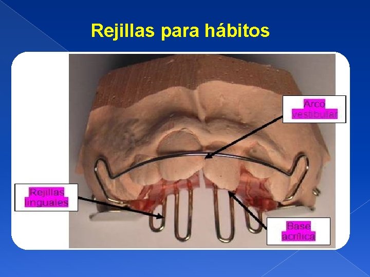 Rejillas para hábitos 