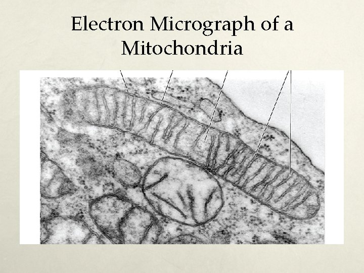 Electron Micrograph of a Mitochondria 