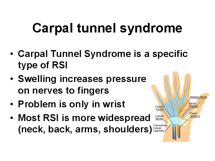 Carpal tunnel syndrome • Carpal Tunnel Syndrome is a specific type of RSI •