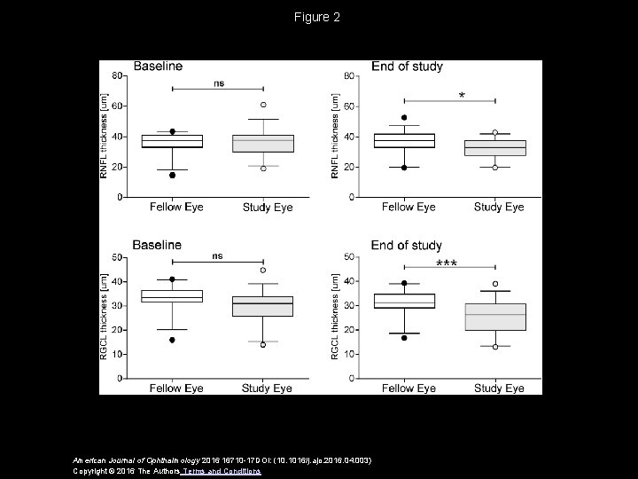 Figure 2 American Journal of Ophthalmology 2016 16710 -17 DOI: (10. 1016/j. ajo. 2016.