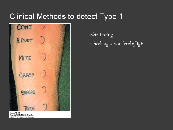 Clinical Methods to detect Type 1 Skin testing Checking serum level of Ig. E