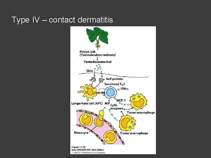 Type IV – contact dermatitis 